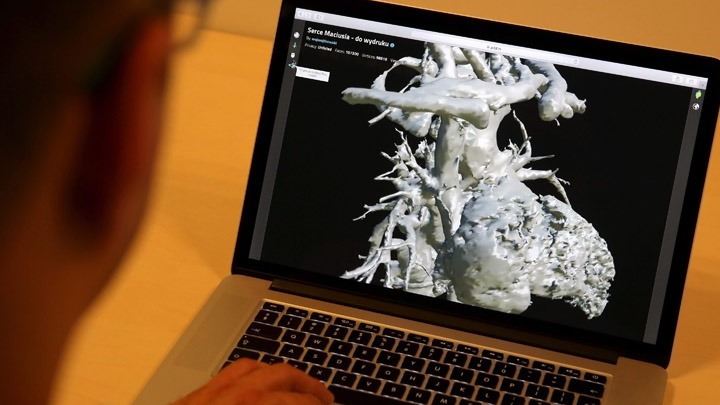 Μελέτη: Παράγοντες Κινδύνου για Καρδιακά Νοσήματα