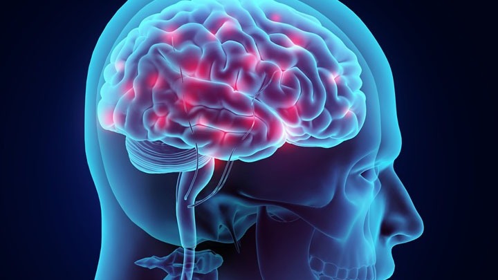 Νέα κλινική μελέτη: Αντιδιαβητικά φάρμακα βελτιώνουν την υγεία του εγκεφάλου σε ασθενείς με Αλτσχάιμερ